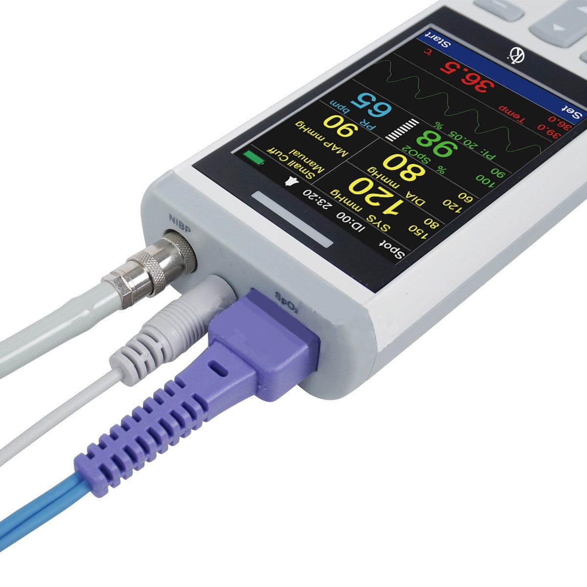 Moniteur Vétérinaire Portable de Signes Vitaux YR06106 – 1
